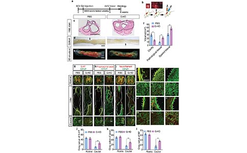 新型水凝胶搭载抗炎药物与生长因子,加速SCI创口愈合,促进轴突再生 新型水凝胶搭载抗炎药物与生长因子,加速SCI创口愈合,促进轴突再生