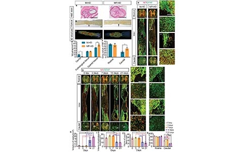 新型水凝胶搭载抗炎药物与生长因子,加速SCI创口愈合,促进轴突再生 新型水凝胶搭载抗炎药物与生长因子,加速SCI创口愈合,促进轴突再生