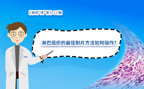 淋巴组织的最佳制片方法如何操作? 淋巴组织的最佳制片方法如何操作?