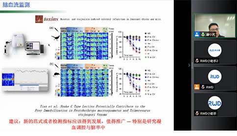 大成学堂 | 卒中研究系列讲座3期精彩全放送!让你一次就学透! 大成学堂 | 卒中研究系列讲座3期精彩全放送!让你一次就学透!