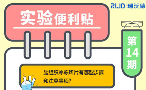 脑组织冰冻切片有哪些步骤和注意事项 脑组织冰冻切片有哪些步骤和注意事项