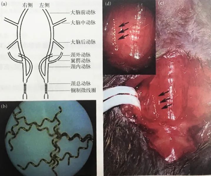小鼠二血管狭窄模型操作步骤 小鼠二血管狭窄模型操作步骤