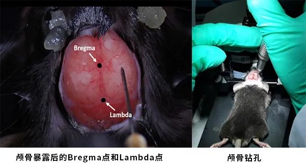 暴露颅骨 暴露颅骨