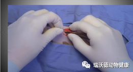 沿腹中线切开腹壁 沿腹中线切开腹壁