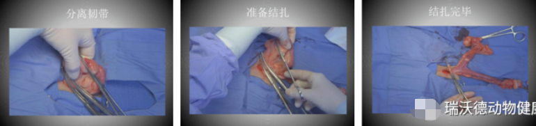 子宫结扎1 子宫结扎1