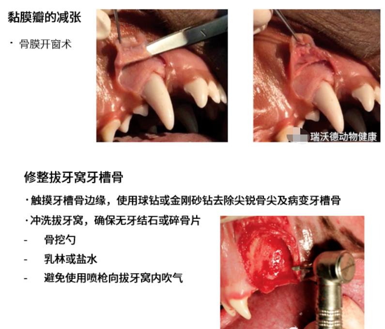 骨膜开窗 骨膜开窗