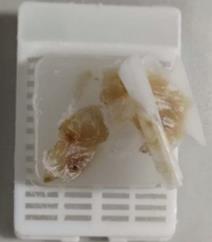 脱水过度 脱水过度