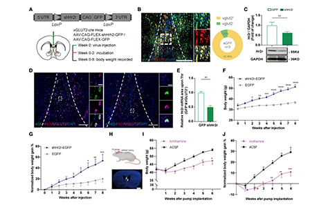 Current Biology：依赖内侧隔核H2R信号的组胺能环路能够调控进食行为