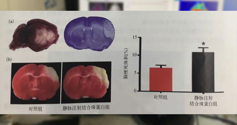 大脑中动脉远端阻塞模型制作及评估