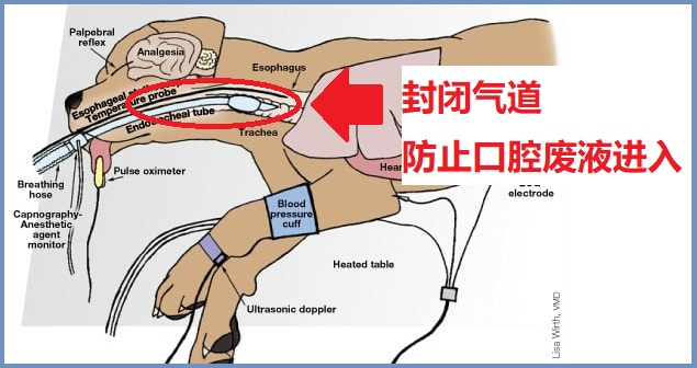 气管插管
